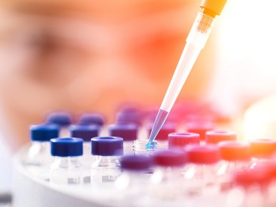 PCR Yöntemi Nedir? Corona Virüs için PCR Testi Nasıl Uygulanır?